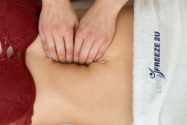 diastasis recti treatment Stockport
