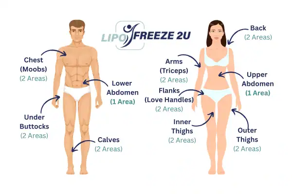 Areas you can have fat freezing treatment Stockport