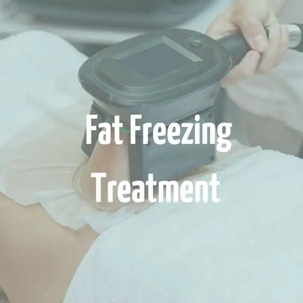 fat freezing treatment Stockport