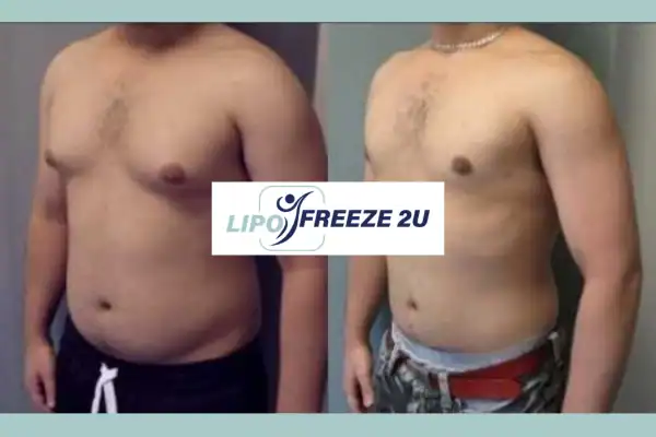 How Long Does It Take to See Results Stockport?