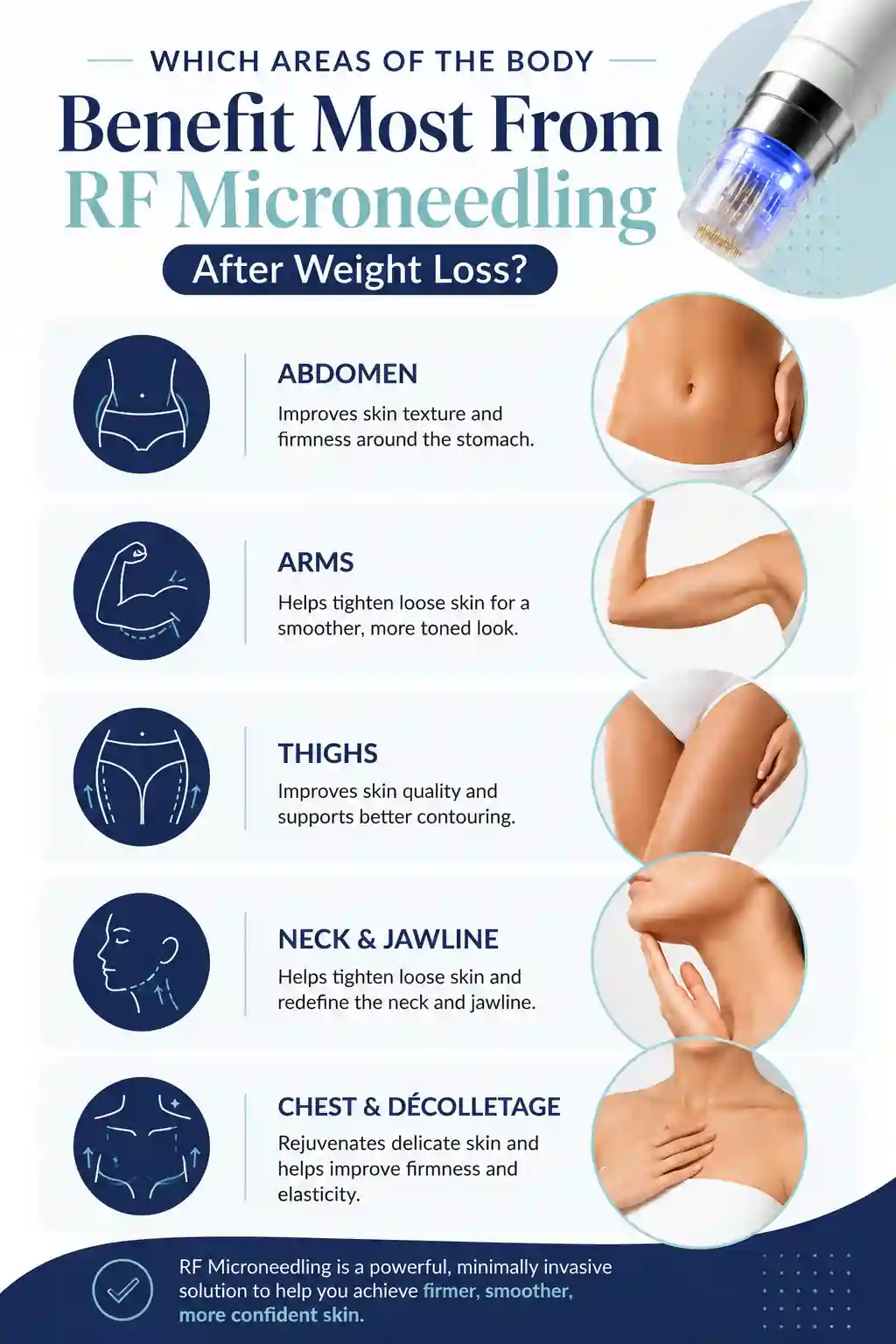 Which Areas of the Body Benefit Most From RF Microneedling After Weight Loss Stockport